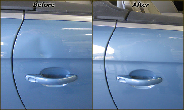 Dent Removal